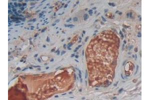 Detection of TNFSF14 in Human Rectum Tissue using Polyclonal Antibody to Tumor Necrosis Factor Ligand Superfamily, Member 14 (TNFSF14) (TNFSF14 Antikörper  (AA 62-240))