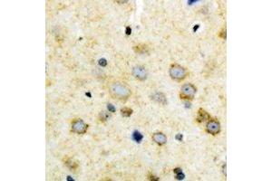 Immunohistochemical analysis of NODAL staining in human brain formalin fixed paraffin embedded tissue section. (Nodal Antikörper  (C-Term))