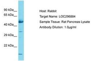 Image no. 1 for anti-Glucocorticoid Induced Transcript 1 (GLCCI1) (AA 255-304) antibody (ABIN6750335) (GLCCI1 Antikörper  (AA 255-304))