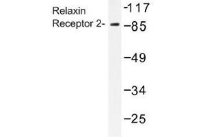 Image no. 1 for anti-Relaxin/insulin-Like Family Peptide Receptor 2 (RXFP2) antibody (ABIN317772) (RXFP2 Antikörper)
