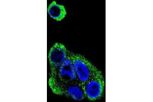 Immunofluorescence (IF) image for anti-Alcohol Dehydrogenase 1B (Class I), beta Polypeptide (ADH1B) antibody (ABIN3002782) (ADH1B Antikörper)