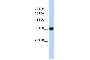 WB Suggested Anti-TNRC5 Antibody Titration:  0. (TNRC5 Antikörper  (C-Term))