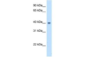 WB Suggested Anti-ABHD5 Antibody Titration:  5. (ABHD5 Antikörper  (N-Term))