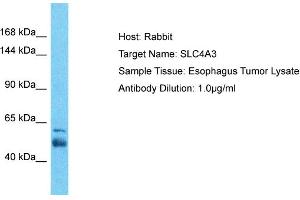 Host: Rabbit Target Name: SLC4A3 Sample Tissue: Human Esophagus Tumor Antibody Dilution: 1ug/ml