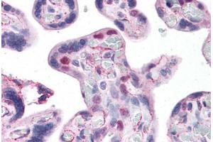 Human Placenta: Formalin-Fixed, Paraffin-Embedded (FFPE) (HMGB2 Antikörper  (AA 1-196))