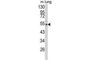 Western blot analysis of Fibulin-3 (arrow) in mouse lung tissue lysates (35ug/lane) using Fibulin-3  Antibody  (N-term).