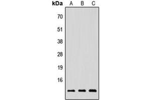 Western blot analysis of NRG4 expression in HEK293T (A), Raw264. (Neuregulin 4 Antikörper  (Center))