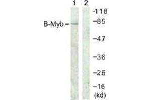 Western blot analysis of extracts from A549 cells, using B-Myb (Ab-577/581) Antibody. (MYBL2 Antikörper  (AA 551-600))