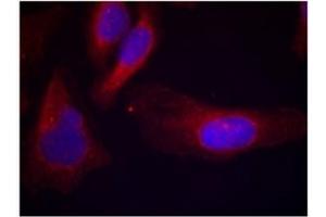 Image no. 1 for anti-Cas-Br-M (Murine) Ecotropic Retroviral Transforming Sequence (CBL) (pTyr700) antibody (ABIN319294) (CBL Antikörper  (pTyr700))