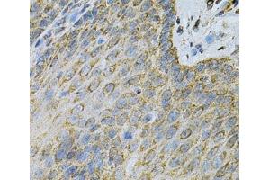 Immunohistochemistry of paraffin-embedded Human esophagus using AK1 Polyclonal Antibody at dilution of 1:100 (40x lens). (Adenylate Kinase 1 Antikörper)