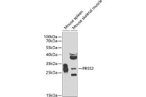 Western blot analysis of extracts of various cell lines, using PRSS2 antibody (ABIN6131363, ABIN6146279, ABIN6146280 and ABIN6223919) at 1:1000 dilution. (PRSS2 Antikörper  (AA 24-247))