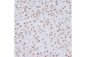 Immunohistochemistry of paraffin-embedded rat liver using Phospho-ERK1-Y204 antibody (ABIN3019889, ABIN3019890, ABIN3019891 and ABIN1681795) at dilution of 1:100 (40x lens). (ERK1 Antikörper  (pTyr204))