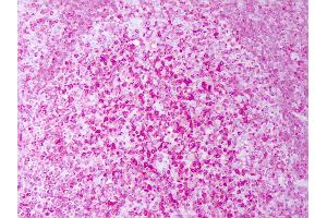 Anti-CD74 antibody IHC of human tonsil, lymphocytes. (CD74 Antikörper)