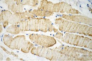 Immunohistochemistry was performed on paraffin-embedded mouse skeletal muscle using desmin antibody (ABIN7798314), 1:200).