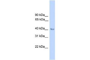 WB Suggested Anti-ALAD Antibody Titration:  0. (ALAD Antikörper  (N-Term))
