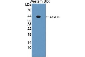 Detection of recombinant LXRa using Polyclonal Antibody to Liver X Receptor Alpha (LXRa) (NR1H3 Antikörper  (AA 95-434))