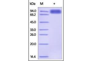 Human TYRO3, Fc Tag on SDS-PAGE under reducing (R) condition. (TYRO3 Protein (AA 41-428) (Fc Tag))