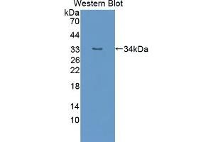 Detection of Recombinant TTK, Mouse using Polyclonal Antibody to TTK Protein Kinase (TTK) (Mps1 Antikörper  (AA 527-786))
