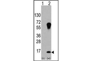 Western blot analysis of LC3 (APG8a) (arrow) using LC3 Antibody . (MAP1LC3A Antikörper)