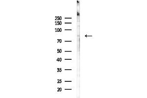anti-Glucosamine (UDP-N-Acetyl)-2-Epimerase/N-Acetylmannosamine Kinase (GNE) antibody