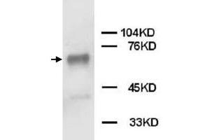 Western Blot analysis of PTPN11 expression from Jurkat cell lyate with PTPN11 polyclonal antibody . (PTPN11 Antikörper  (C-Term))