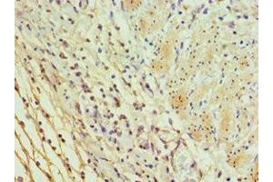 Immunohistochemistry of paraffin-embedded human epityphlon tissue using ABIN7156037 at dilution of 1:100 (ICOSLG Antikörper  (AA 19-256))