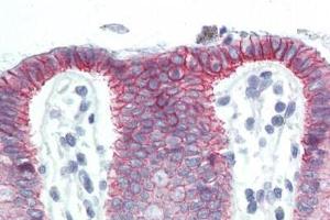 Human Colon (formalin-fixed, paraffin-embedded) stained with CTNNB1 antibody ABIN364501 at 10 ug/ml followed by biotinylated anti-mouse IgG secondary antibody ABIN481714, alkaline phosphatase-streptavidin and chromogen. (CTNNB1 Antikörper  (C-Term))