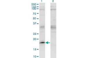 Western Blot analysis of LMO2 expression in transfected 293T cell line by LMO2 monoclonal antibody (M07), clone 4E2. (LMO2 Antikörper  (AA 16-102))