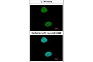 Image no. 3 for anti-General Transcription Factor IIIC, Polypeptide 4 (GTF3C4) (AA 73-334) antibody (ABIN1498564) (GTF3C4 Antikörper  (AA 73-334))