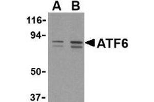 Western blot analysis of ATF6 in MCF7 cell lysate with this product atF6 antibody at (A) 0. (ATF6 Antikörper  (C-Term))