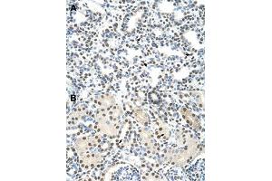 Immunohistochemical staining (Formalin-fixed paraffin-embedded sections) of human lung (A) and human kidney (B) with AKAP8L polyclonal antibody  at 4-8 ug/mL working concentration. (AKAP8L Antikörper  (C-Term))