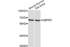 Western blot analysis of extracts of various cell lines, using NEPRO Antibody (ABIN5998324) at 1/1000 dilution. (NEPRO Antikörper)