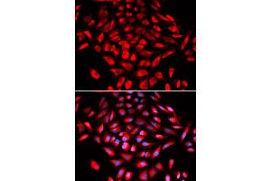 Immunofluorescence analysis of U2OS cells using CAMK4 antibody (ABIN5973050). (CAMK4 Antikörper)