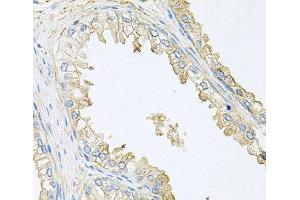Immunohistochemistry of paraffin-embedded Human prostate using PPP3R1 Polyclonal Antibody at dilution of 1:100 (40x lens). (PPP3R1 Antikörper)