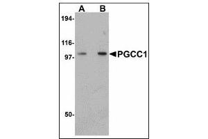 Western blot analysis of PGCC1 in rat thymus tissue lysate with PGCC1 antibody at (A) 0. (FAM120B Antikörper  (C-Term))