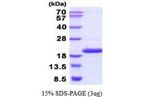 NME4 Protein (AA 33-187) (His tag)