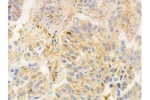 ABIN6264161 and ABIN6276567 at 1/100 staining human normal kidney tissue by IHC-P.