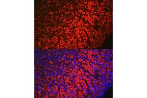 Immunofluorescence analysis of mouse adrenal gland using HSD3B1 Rabbit pAb (ABIN6131041, ABIN6142016, ABIN6142017 and ABIN6224059) at dilution of 1:100 (40x lens). (HSD3B1 Antikörper  (AA 1-290))