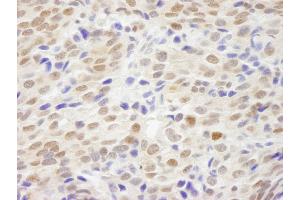 anti-Nonhomologous End-Joining Factor 1 (NHEJ1) (C-Term) antibody