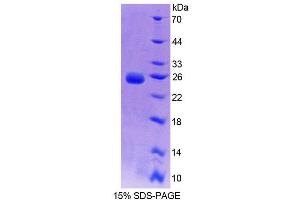 SDS-PAGE analysis of Rat BCAT2 Protein. (BCAT2 Protein)