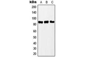 Western blot analysis of PNPT1 expression in Jurkat (A), MCF7 (B), HeLa (C) whole cell lysates. (PNPT1 Antikörper  (C-Term))