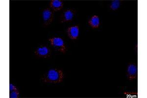 Proximity Ligation Assay (PLA) image for HDAC2 & HDAC1 Protein Protein Interaction Antibody Pair (ABIN1340374)