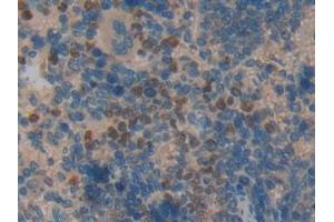 Immunohistochemistry (IHC) image for anti-Chemokine (C-C Motif) Ligand 6 (CCL6) (AA 21-115) antibody (ABIN7439696)