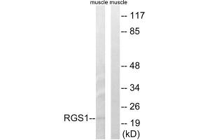 Western blot analysis of extracts from mouse muscle cells, using RGS1 antibody. (RGS1 Antikörper  (Internal Region))