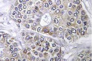 Immunohistochemistry (IHC) analyzes of Bcl-2 antibody in paraffin-embedded human brain tissue. (Bcl-2 Antikörper)