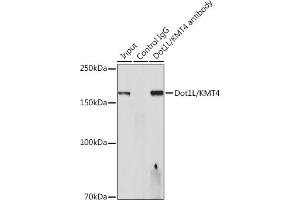 Immunoprecipitation analysis of 300 μg extracts of HeLa cells using 3 μg Dot1L/KMT4 antibody (ABIN7266837).