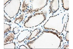 Immunohistochemical staining of paraffin-embedded Human Kidney tissue using anti-MIOX mouse monoclonal antibody. (MIOX Antikörper)