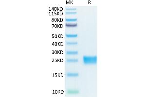 SDS-PAGE (SDS) image for Interleukin 17A (IL17A) (AA 26-158) protein (His-Avi Tag,Biotin) (ABIN7274996)