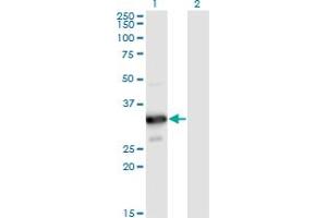 Western Blot analysis of MYOZ2 expression in transfected 293T cell line by MYOZ2 monoclonal antibody (M02), clone 1D4. (MYOZ2 Antikörper  (AA 1-264))