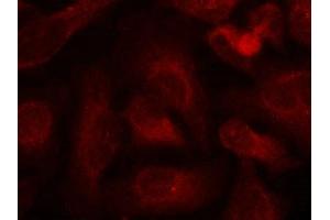 Immunofluorescence (IF) image for anti-Abelson Murine Leukemia Viral Oncogene Homolog 1/2 (ABL1/ABL2) (pTyr393), (pTyr439) antibody (ABIN7138994)